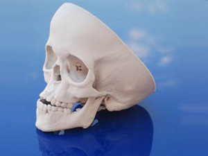 A 3D printed model of a patient's skull to be used in pre-operation planning. (Photograph by Protoform Rapid Prototyping & 3D Printing)