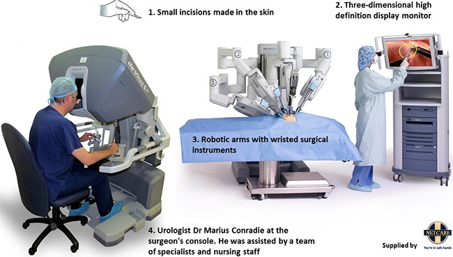 Da Vinci robotic-assisted technology, which was used at the Netcare Waterfall City Hospital to perform a partial nephrectomy for the first time in SA.