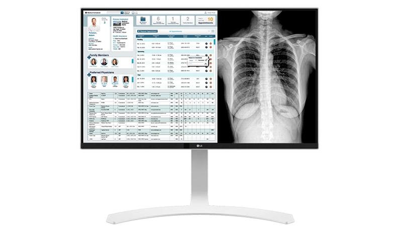 In its maiden move into the medical technology industry, LG Electronics SA has released two state-of-the-art monitors.